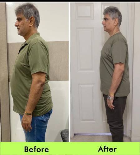 Before-After1 (1)